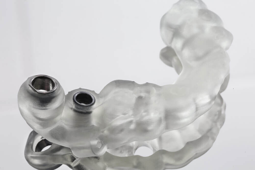 Dental Impressions Digital Impression Cost and benefits iSmile